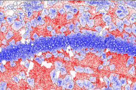 Colorized micrograph of brain tissue. A horizontal strip of tiny blue circles crosses the middle of the image, against a background of red and lighter blue cell-like shapes.