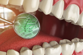 Realistic illustration of an extreme closeup of a person's mouth, with a dental mirror reflecting a microscopic collection of green bacteria