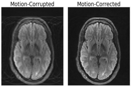 Two side-by-side black and white images of the same brain scan. The one on the left is blurry, and the label "motion-corrupted" appears above it; the one on the right is more clear, and is labeled "motion-corrected."