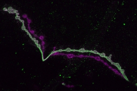 Individual neurons mix multiple RNA edits of key synapse protein, study  finds, MIT News