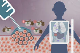 An illustration of an X-ray machine showing the organs inside a silhouette of a body. In the background, a syringe injects gel into a tumor. Immune cells, drawn with exclamation point icons and ninja headbands, swarm the tumor.
