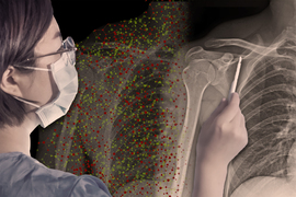 computational social science phd reddit Medical technician looking at an X-ray with the help of an AI assistant