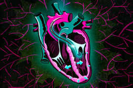 Drawing of a human heart shows a cable with a hook-shaped device inside the heart. Arrows showing movement of the heart.