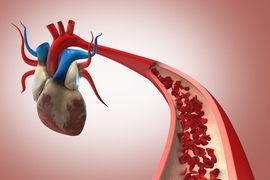 A realistic 3D illustrated heart has a major artery projecting into the foreground with a cutaway view showing red blood cells