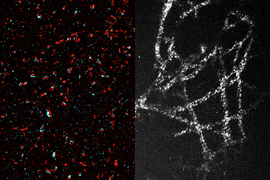 High-resolution images of synapses and microtubules