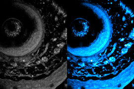 Two images; on left the image is monochrome and blurrier. On right, the image is in blue and shows more of the cellular objects.