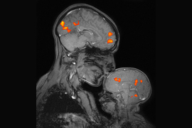 A black-and-white MRI scan of a mother kissing her infant, overlaid with activity, represented by small orange blogs in the brains