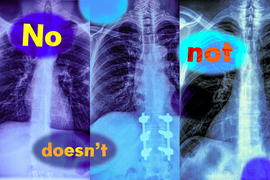 Three x-ray images with the words, “no; not; doesn’t.”