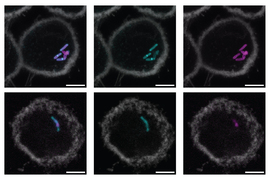 Tuberculosis bacteria