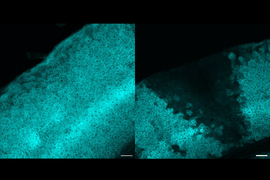 Two square micrographs show an arc of densely-packed brain tissue. Lefthand image shows a continuous arc, but the righthand image features a wedge where the cyan staining is absent.