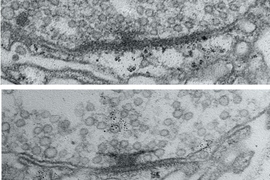 Two stacked electron microscope images show a synapse. A dark T shape features among many tiny bubble-like circles. In the bottom image the T shape is much bigger than in the upper image.