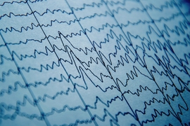 Closeup up paper displaying dark blue traces of many squiggly brain waves as they run across the page