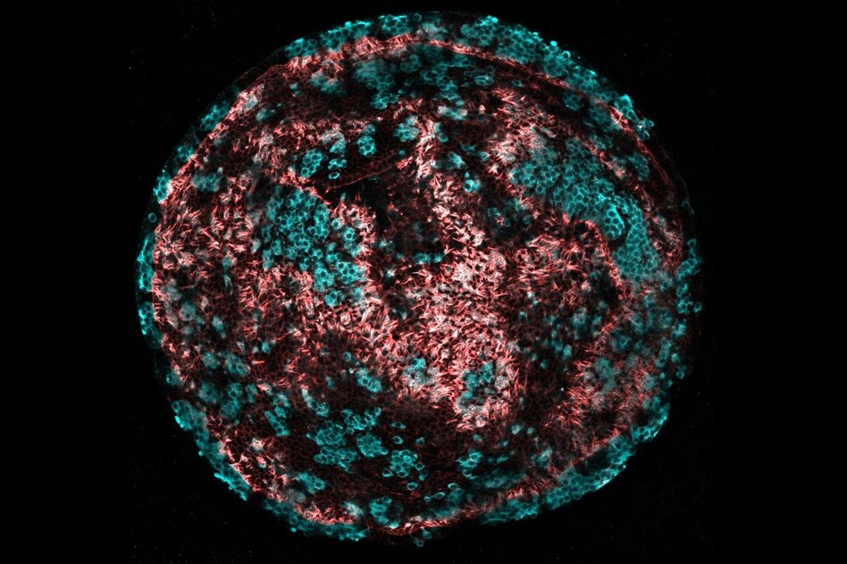 Drug treatment could combat hearing loss