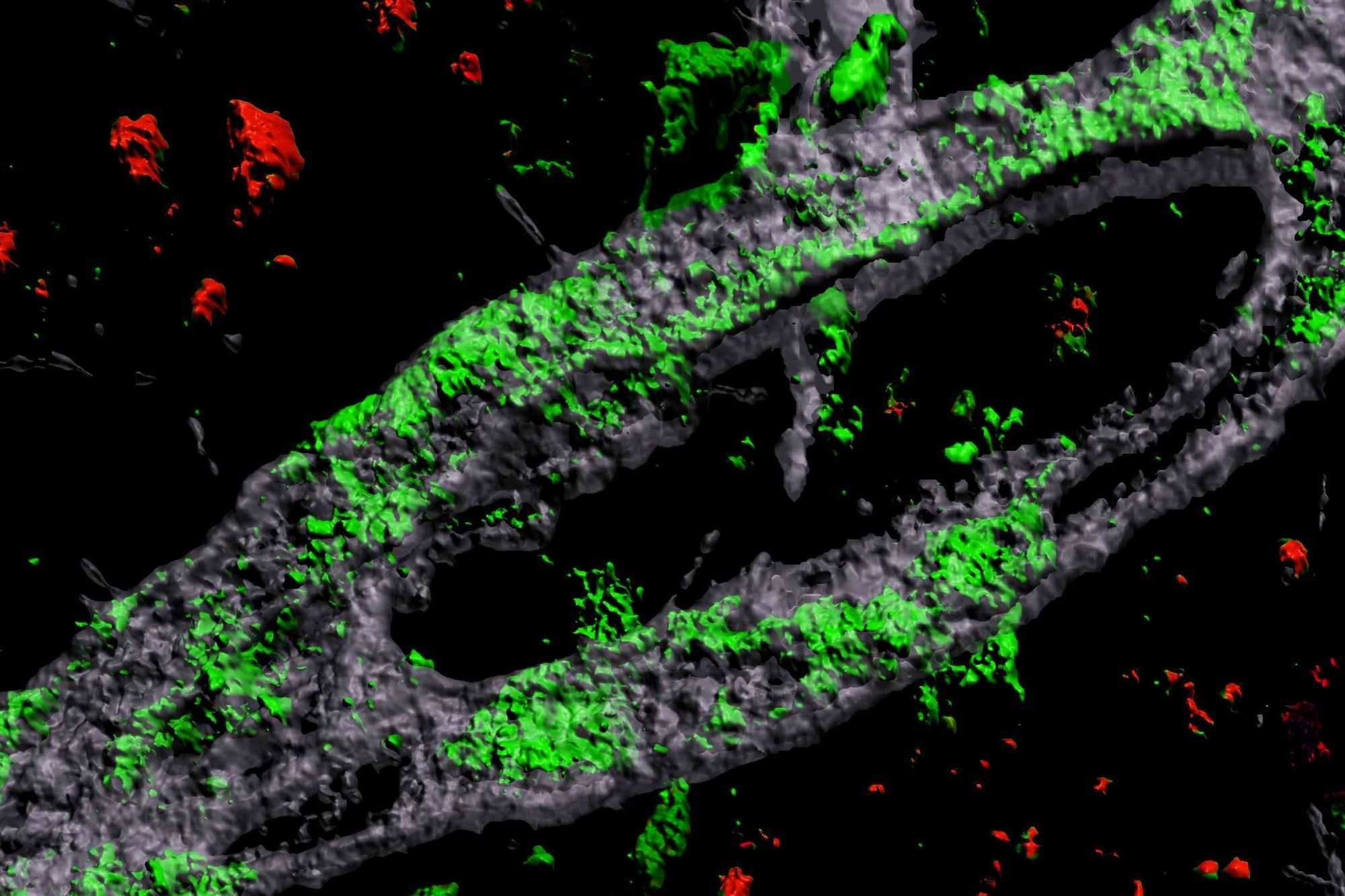 Study finds path for addressing Alzheimer’s blood-brain barrier impairment