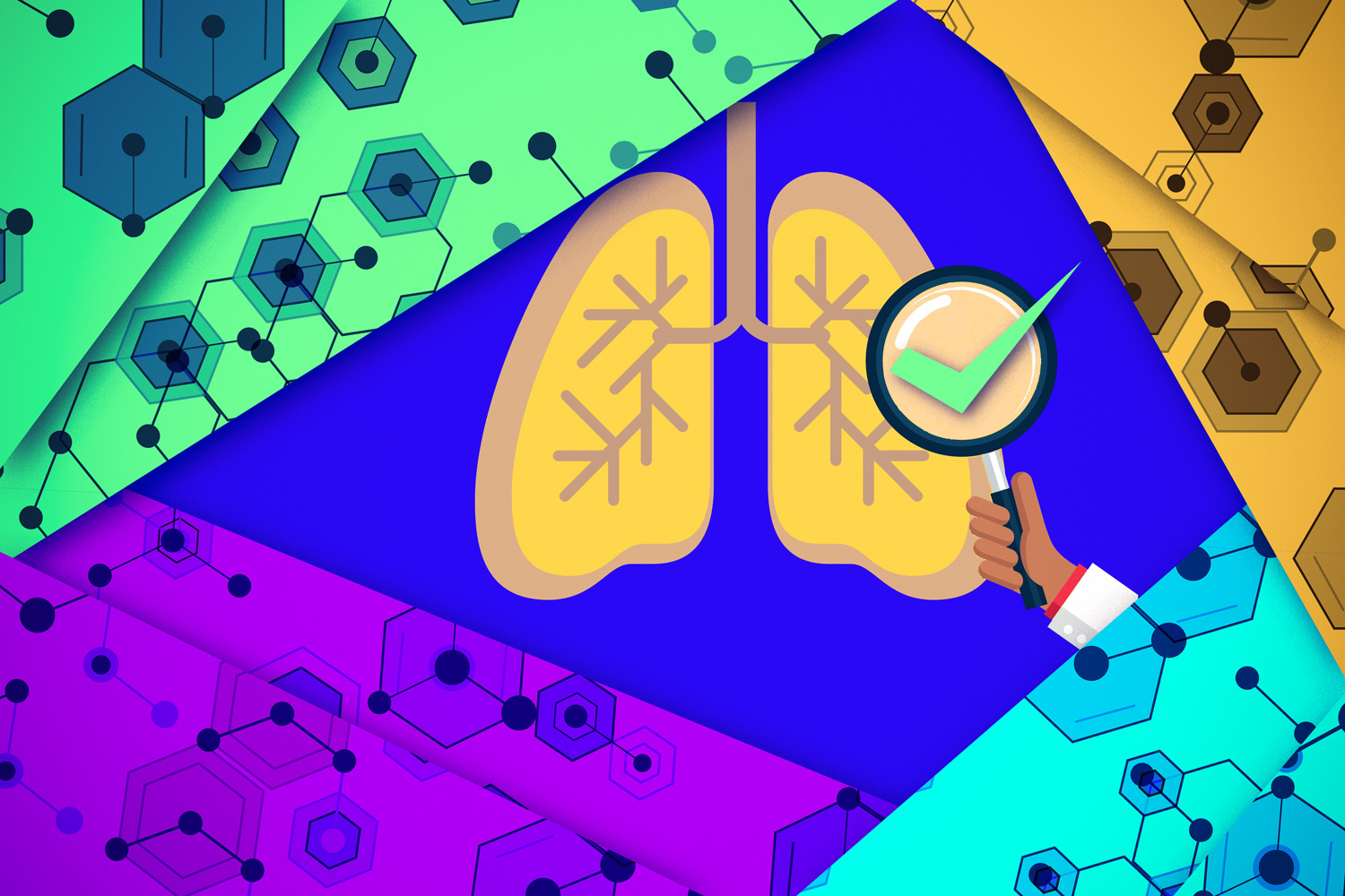 Machine learning uncovers potential new TB drugs | MIT News