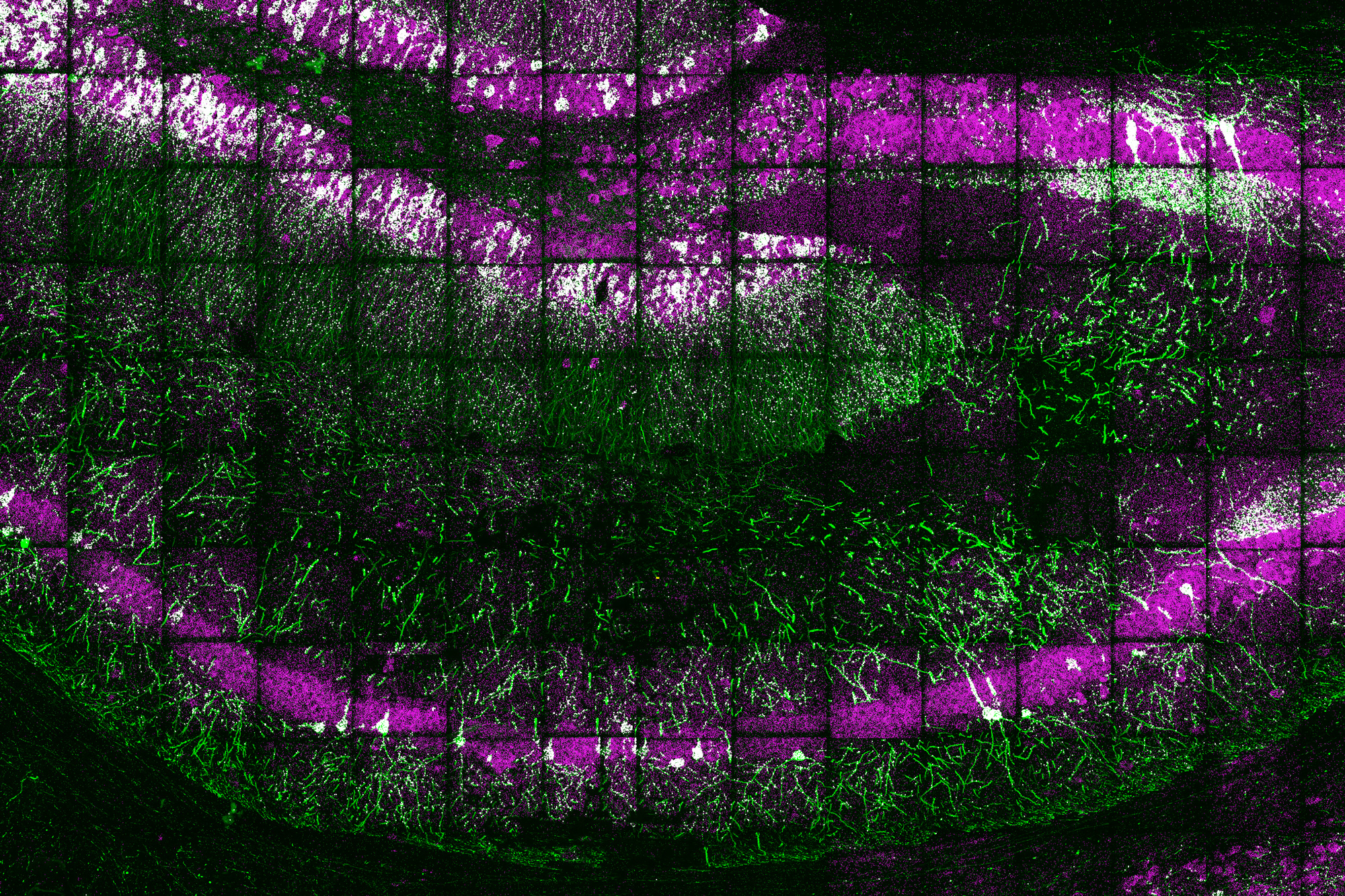 A high-resolution glimpse of gene expression in cells | MIT News