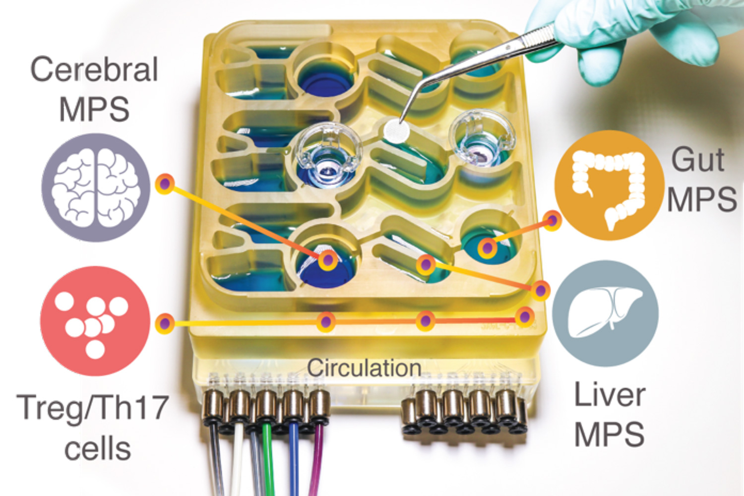 Our gut-brain connection | MIT News