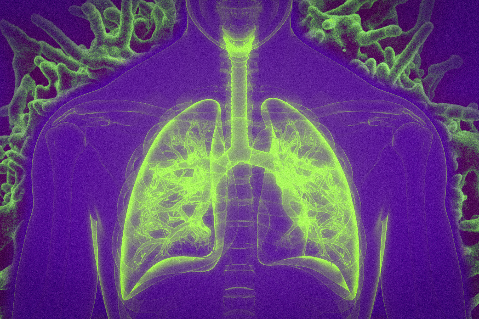 Vaccination by inhalation | MIT News