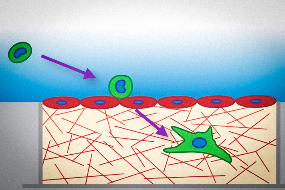 Cancer cells soften as they metastasize, study suggests | MIT News