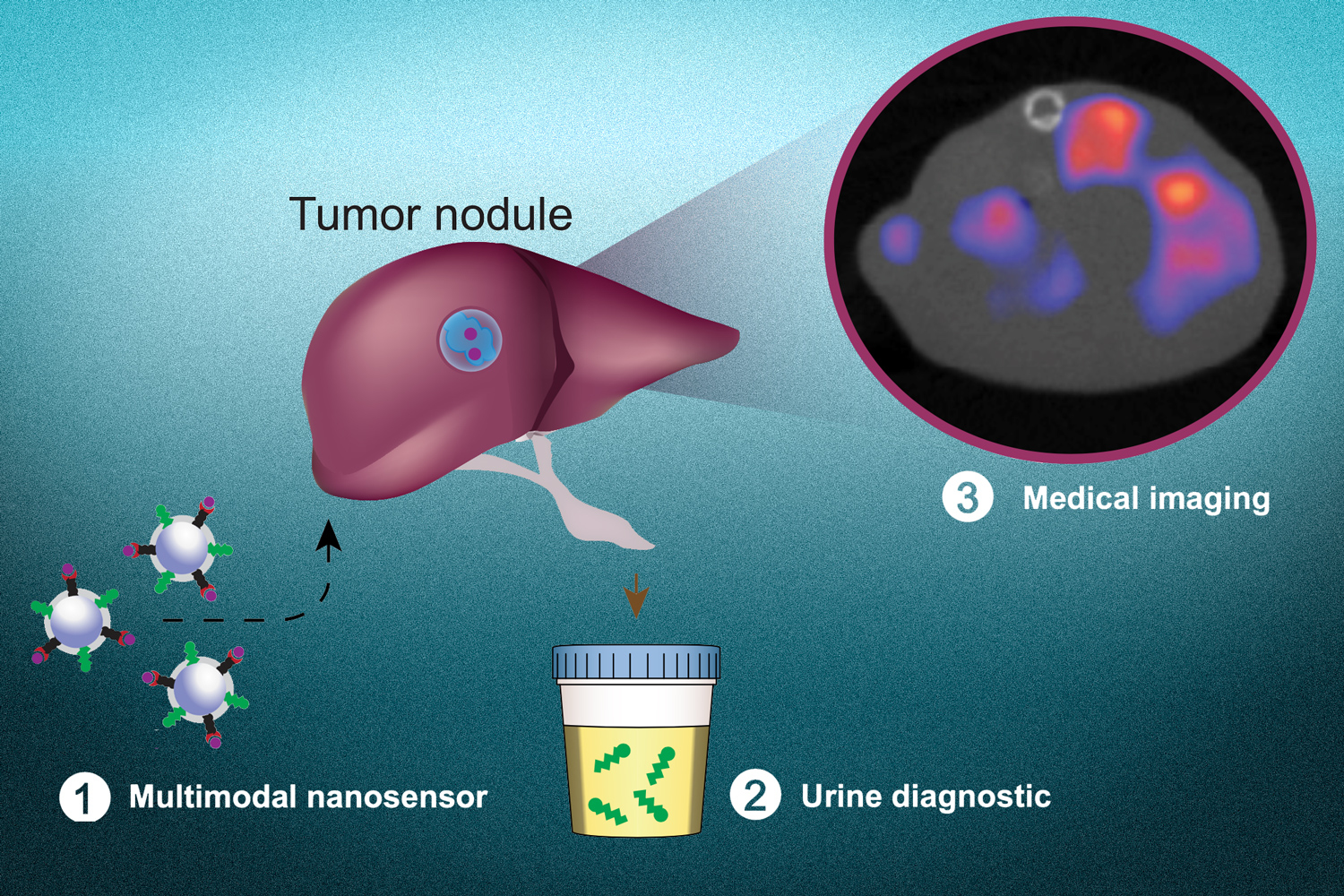 A noninvasive test to detect cancer cells and pinpoint their location