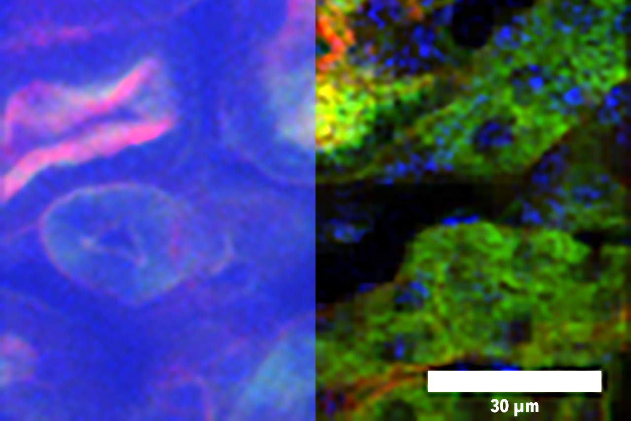 Microscopy technique makes finer images of deeper tissue, more quickly | MIT News