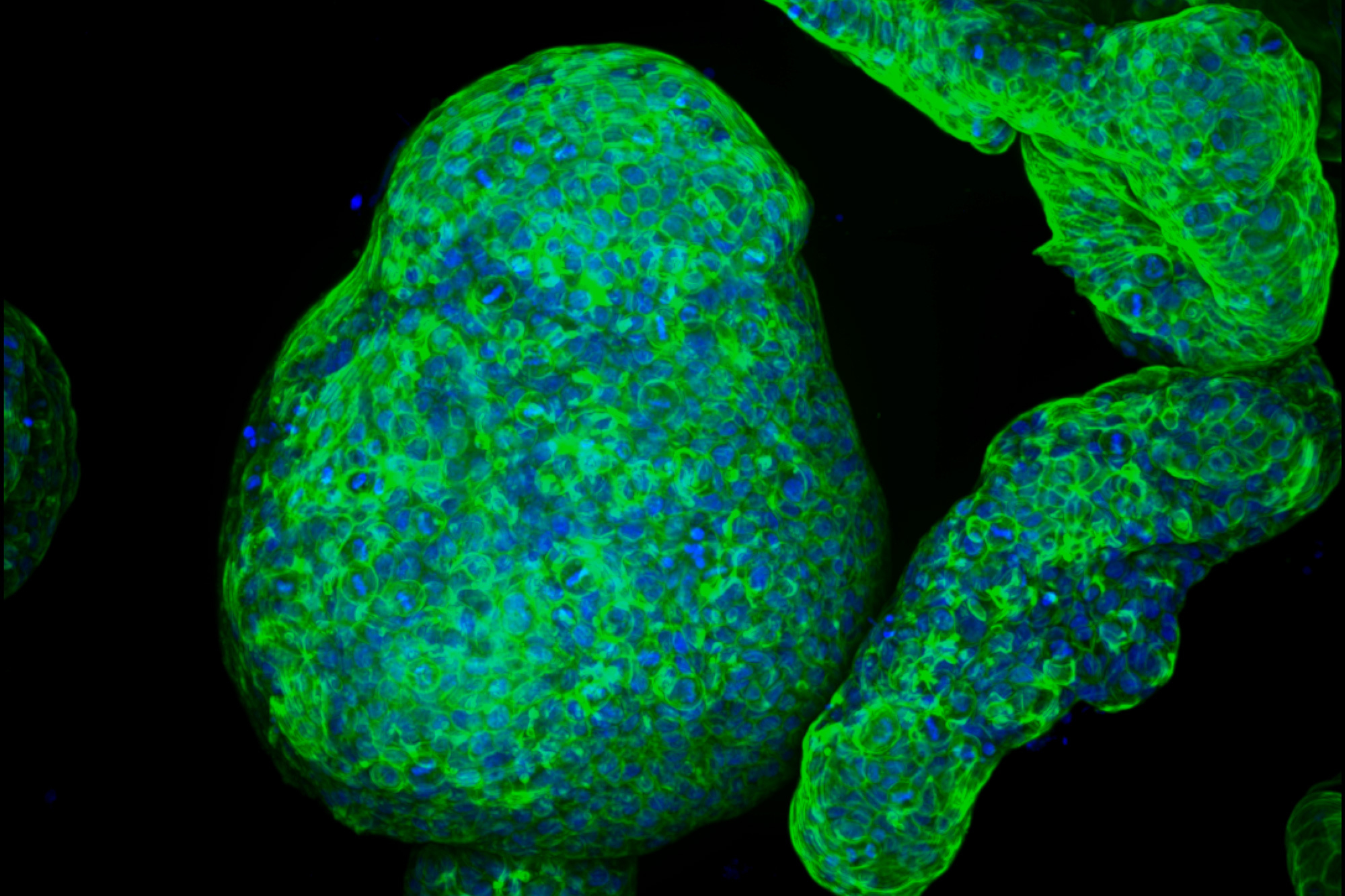 Engineers grow pancreatic “organoids” that mimic the real thing | MIT News