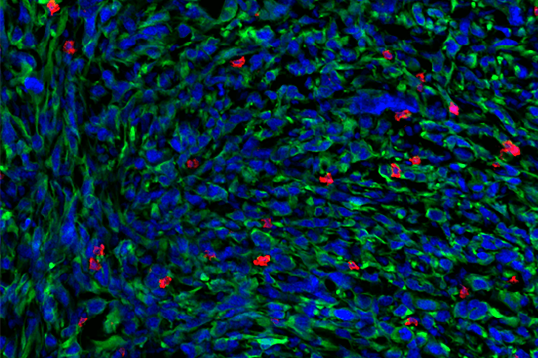 Differences in T cells' functional states determine resistance to cancer therapy