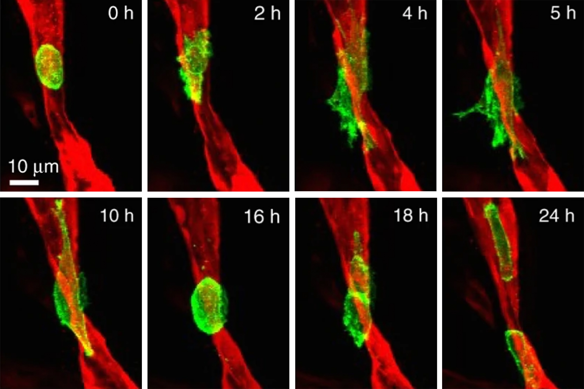 Modeling the mechanisms of metastasis | MIT News