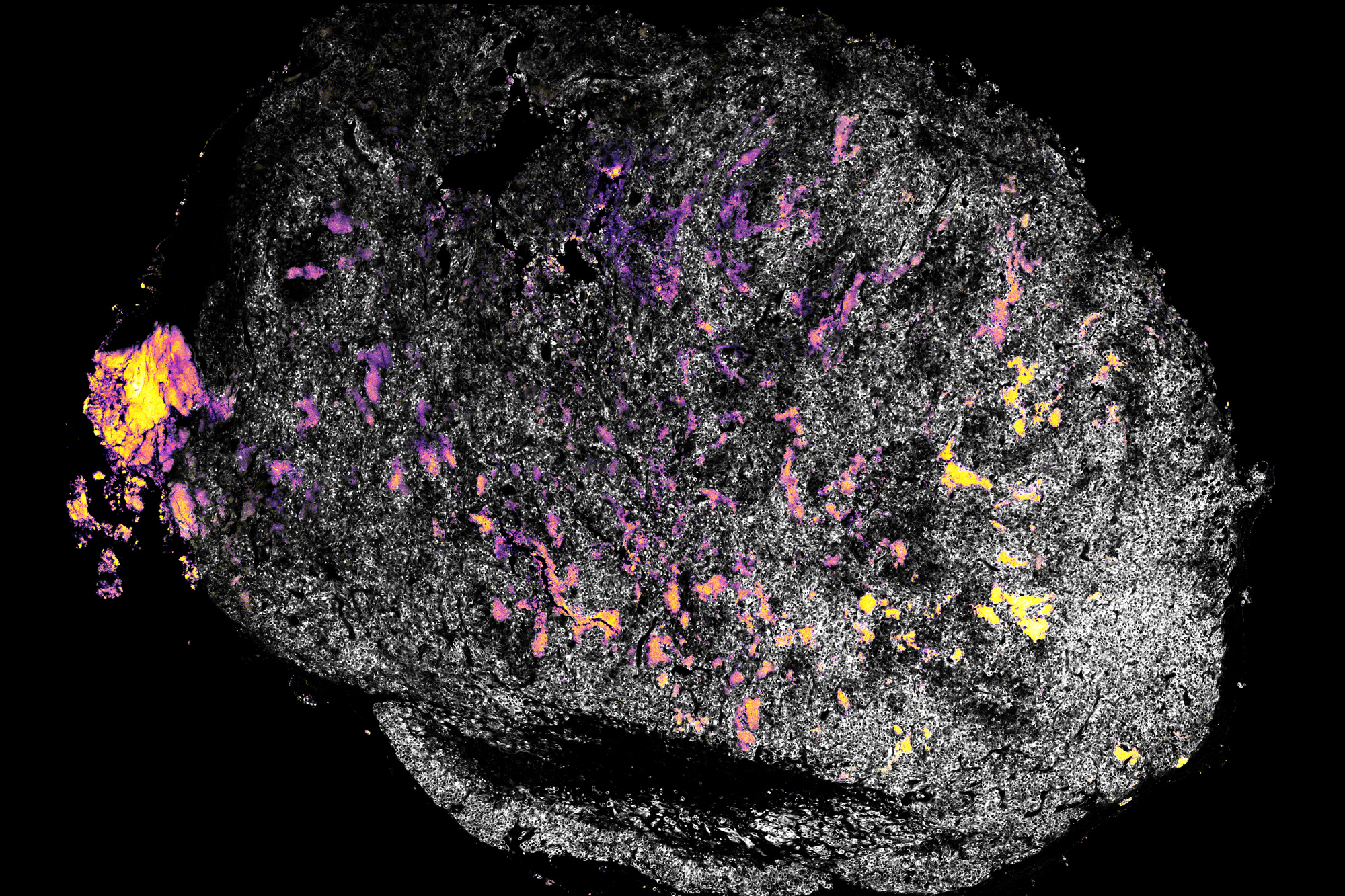 Method for delivering immune system-stimulating drugs may enhance cancer immunotherapy