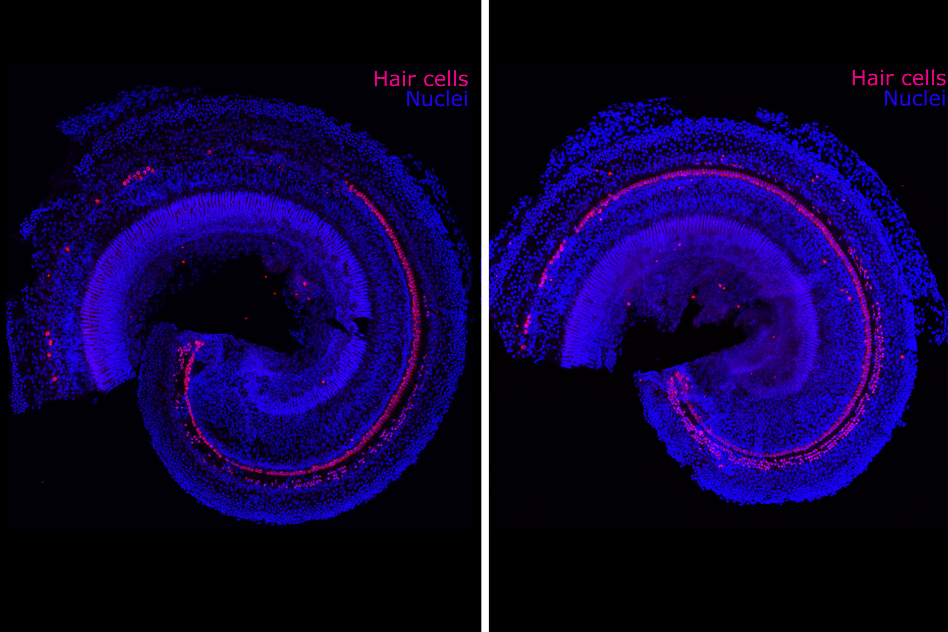 These images show cellular regeneration, in pink, in a preclinical model of sensorineural hearing loss. The control is on the left and the right has been treated.