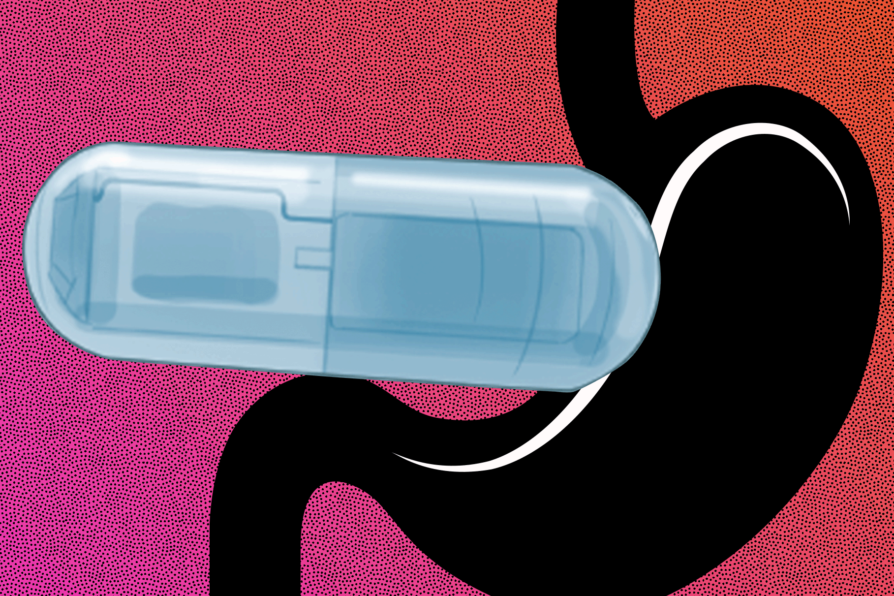 Engineers develop a vibrating, ingestible capsule that might help treat obesity