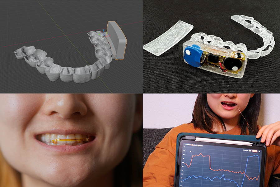 A dental brace developed by researchers at MIT CSAIL and Aarhus University can be fabricated with sensors and feedback components to capture in-mouth interactions and data.