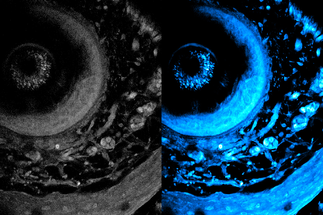 Noninvasive imaging method can penetrate deeper into living tissue