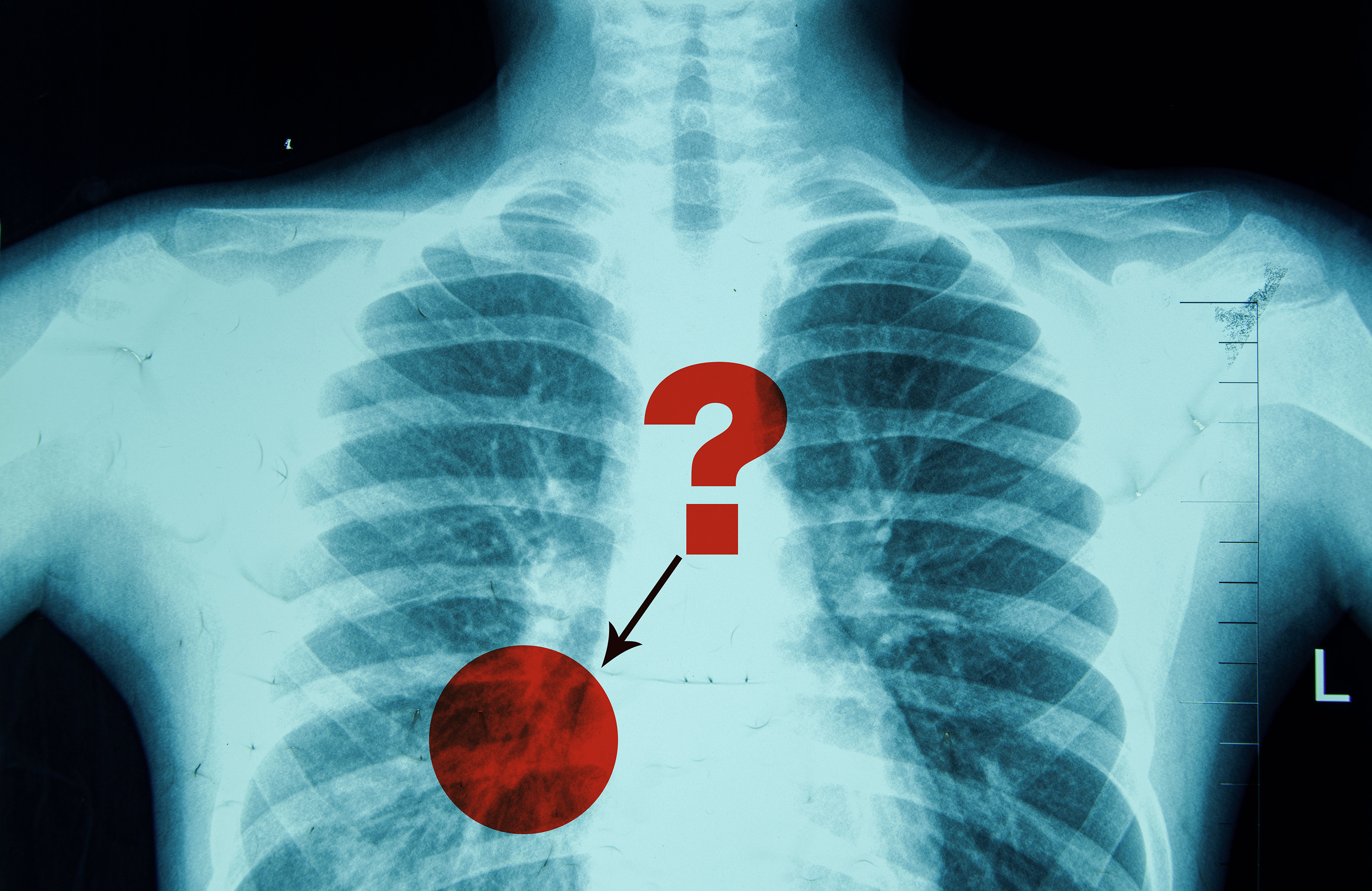 New method assesses and improves the reliability of radiologists’ diagnostic reports