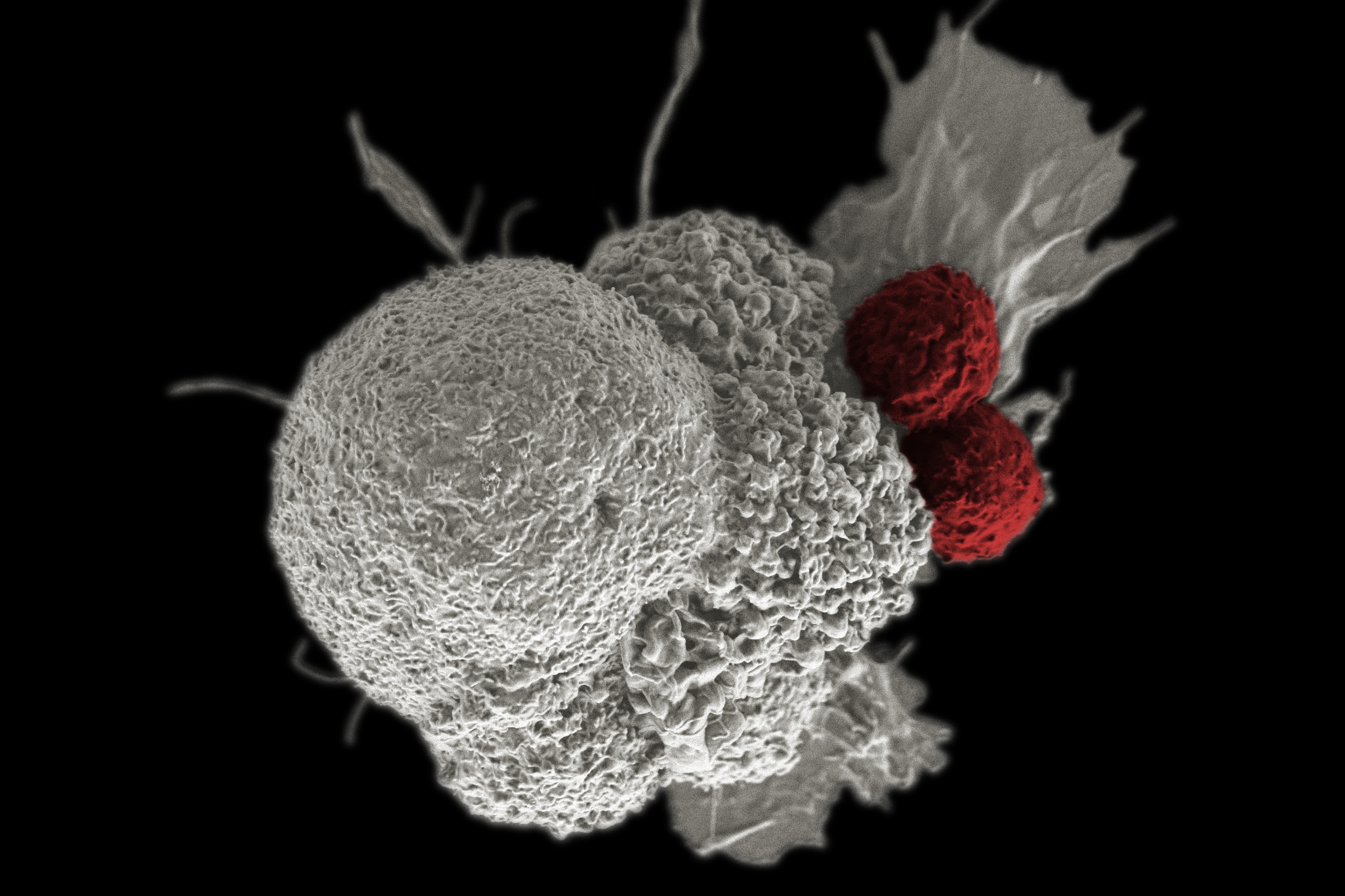 Equipping living cells with logic gates to fight cancer