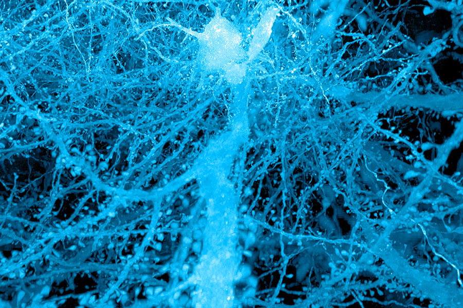 A brief history of expansion microscopy