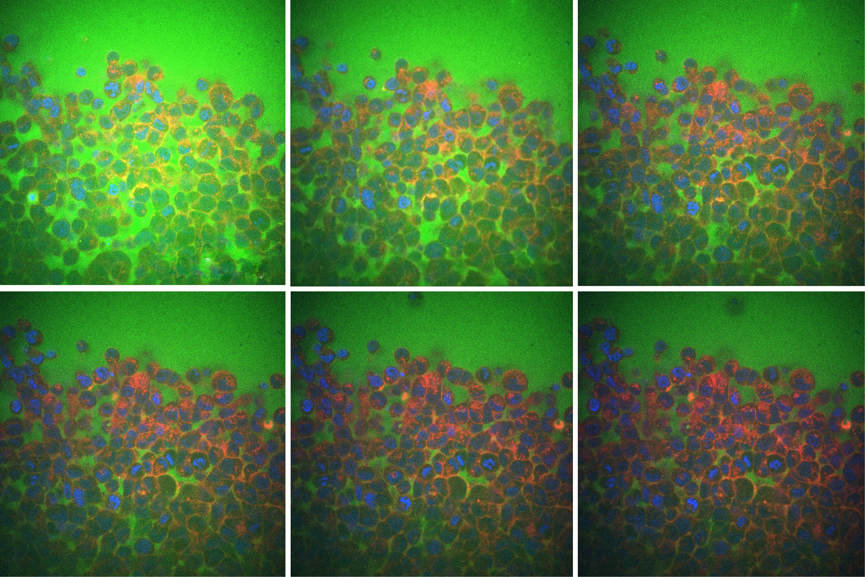 MIT engineers uncover a surprising reason why tissues are flexible or rigid