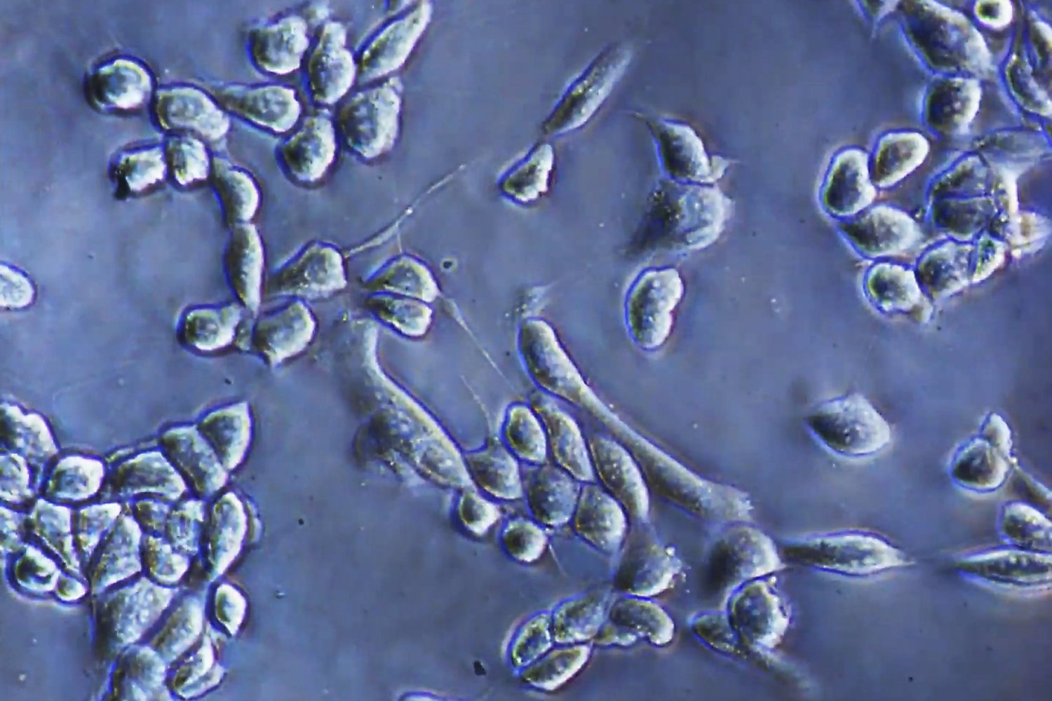 An improved way to detach cells from culture surfaces