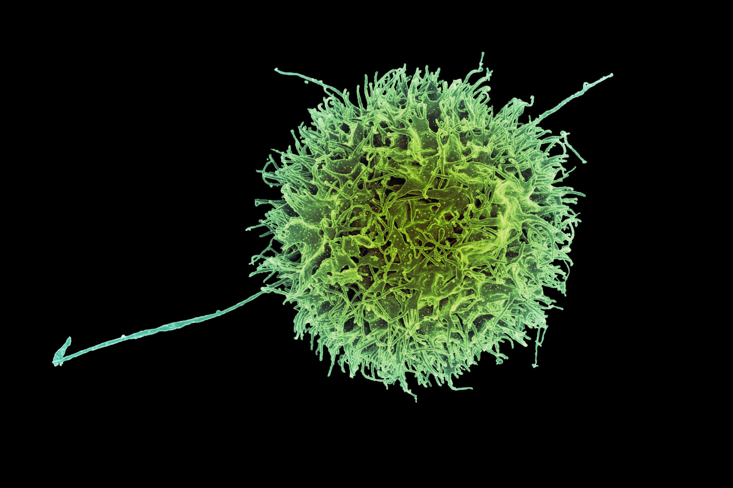 Engineered “natural killer” cells could help fight cancer