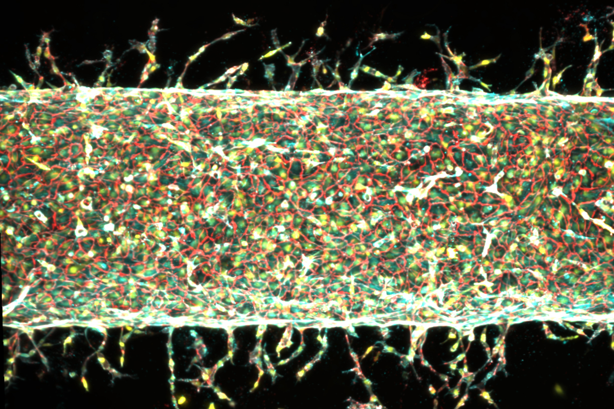 MIT ENGINEERS GROW ARTIFICIAL BLOOD VESSELS ON DEMAND