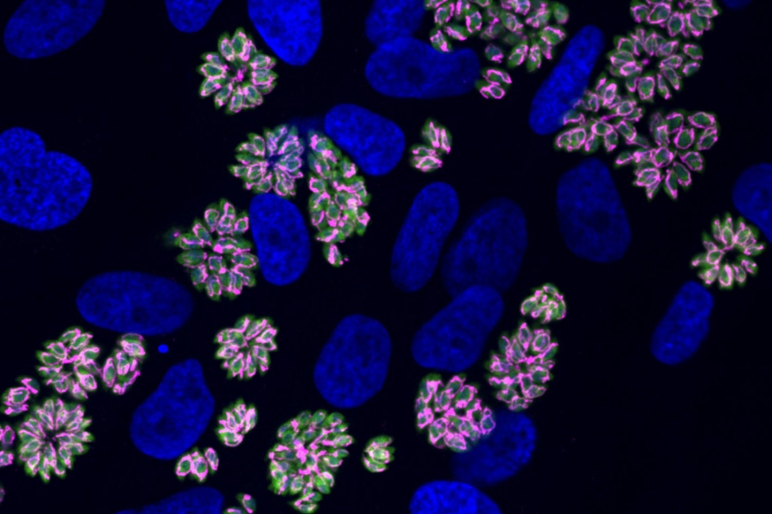 How the Toxoplasma parasite adapts to crowded conditions in host cells