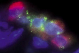Stem cells in the lung of the mouse model for lung cancer.