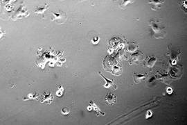 MIT researchers have discovered that treating bone marrow stem cells with a growth factor called EGF promotes their survival and growth when the EGF is tethered to a scaffold. This image shows stem cells with no EGF treatment. <a onclick="MM_openBrWindow('stem-cells-1-enlarged.html','','width=509, height=583')">
<span onmouseover="this.className='cursorChange';">Open image gallery</span>
</a>
<...