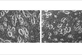 Naturally derived embryonic stem cells from mice (left) are morphologically identical to reprogrammed fibroblasts (right).