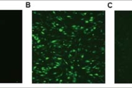 A comparison of different methods of gene delivery, showing delivery of DNA encoding green fluorescent protein (from jellyfish) to human umbilical vein endothelial cells. Image (A) shows delivery by  polyethylenimine, a leading non-biodegradable commercially available polymer. Image (B) shows poly(beta-amino esters) developed at MIT and (C) shows adenovirus.  High levels of DNA delivery are observ...