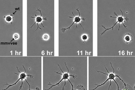 These time lapse frames show development of a normal neuron (top) and a mutated neuron that does not express the Ena/VASP proteins.