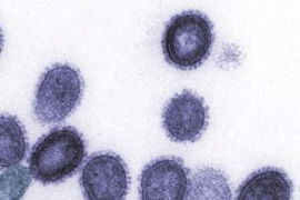 Transmission electron micrograph of avian influenza A H5N1 viruses (purple) released from infected human cell (blue).