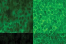 These images show macrophages infected with anthrax. The fluorescent green areas indicate the presence of nitric oxide (NO). In the top two panels, the anthrax can produce NO. At top left, an image taken two hours after infection shows that NO is present. At 18 hours, top right, more NO is present, produced by the macrophages. In the bottom two panels, the anthrax infecting the macrophages is unab...
