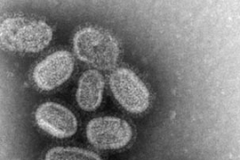 This transmission electron micrograph (TEM) shows the 1918 influenza virus, which CDC researchers re-created in 2005.