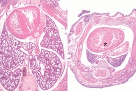 On the left is an image of the lungs of a normal mouse. On the right are the lungs of a mouse in which a family of microRNA genes have been knocked out. The lungs fail to develop normally, and the mice die soon after birth.